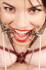 Ring gag