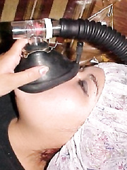 Anesthesia Gassing I