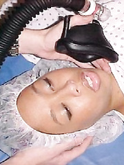 Anesthesia Gassing II